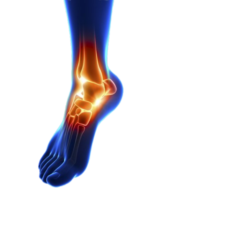 Ankle Fractures - Idaho Foot & Ankle Center