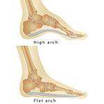 Foot & Ankle Services - Idaho Foot & Ankle Center